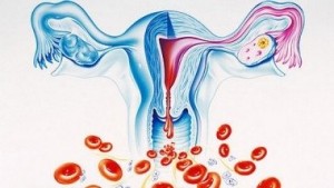 Обильные менструации - симптомы, причины, обследование