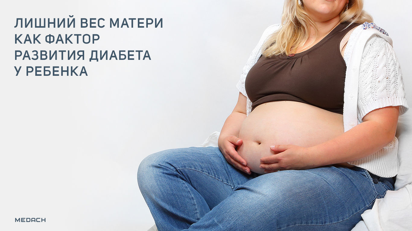 Вес маму. Ведение беременных с лишним весом. Избыточный вес и возможность забеременеть. Ожирение у беременных красивое фото. Беременной поднимать ребенка весом.
