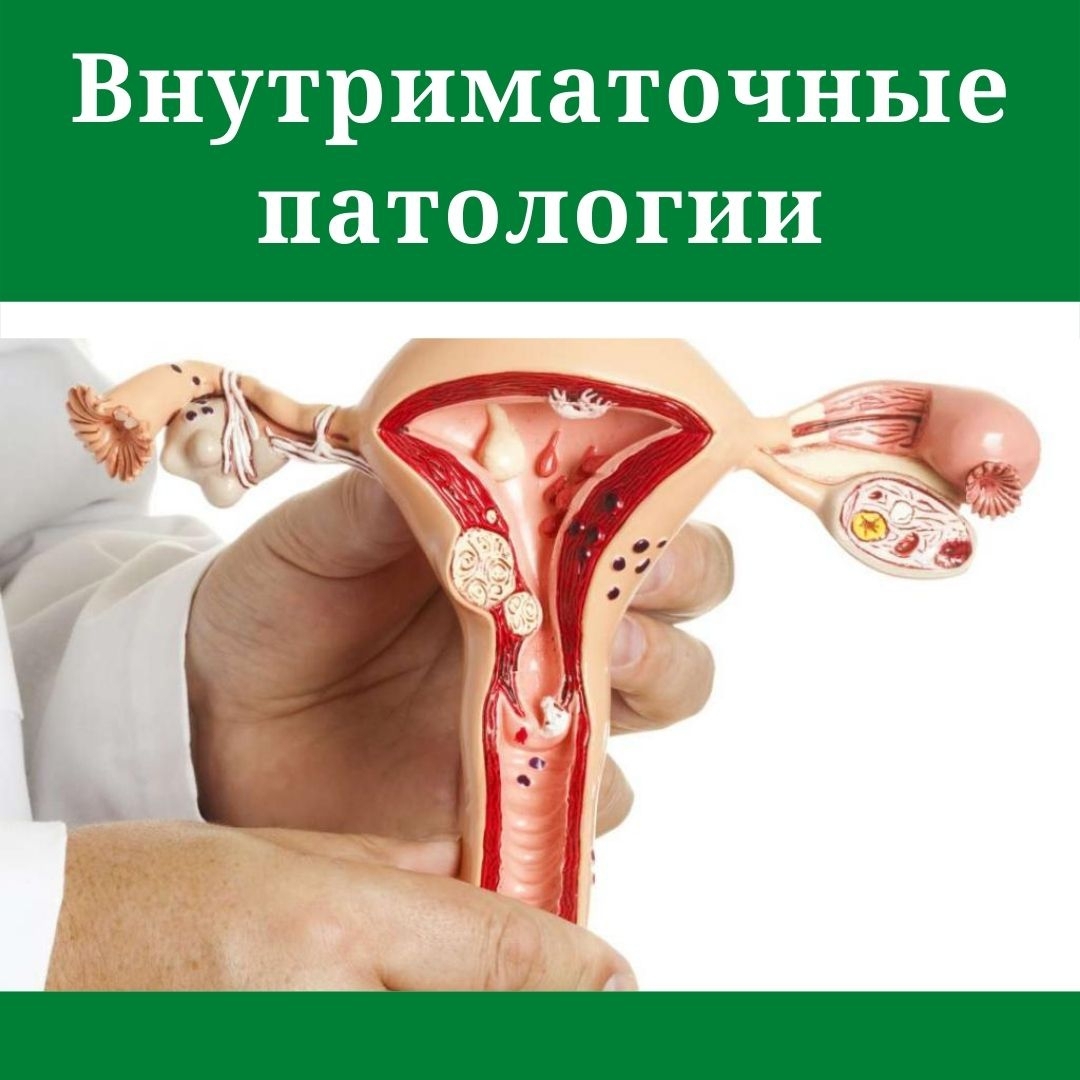 патология полости матки
