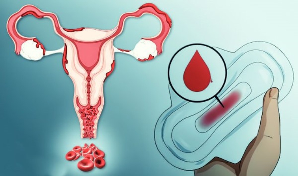 нарушение менструального цикла