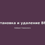 Преимущества ВМС и недостатки. Что выбрать?